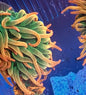 Ultra Rainbow Anemone